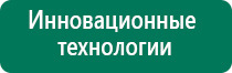 Стл аппарат меркурий